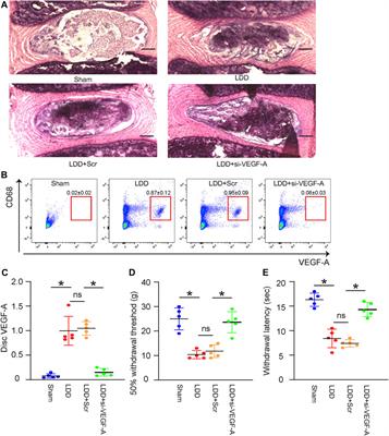 Inhibition of angiogenetic macrophages reduces disc degeneration-associated pain